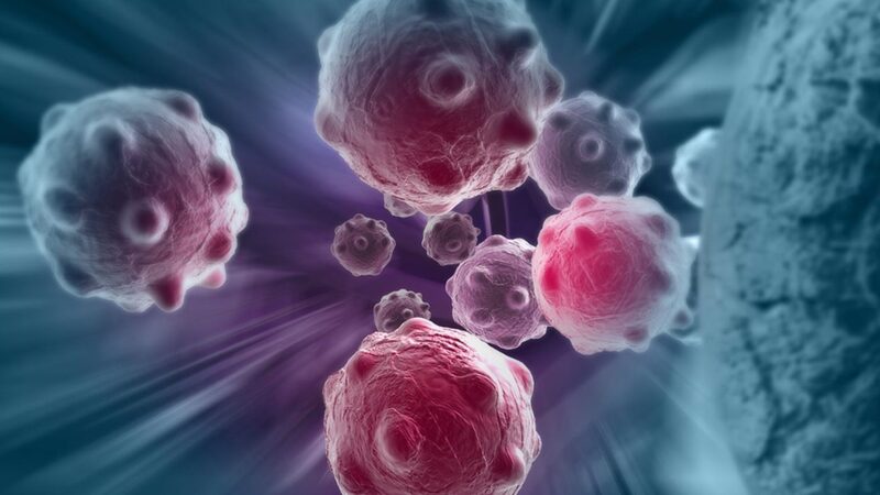 Tumore al pancreas, scoperto perché è aggressivo: aiuterà le terapie 3