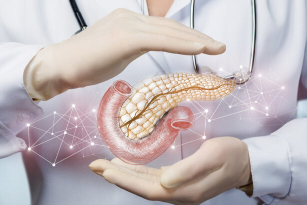 Tumore al pancreas, scoperto perché è aggressivo: aiuterà le terapie 15