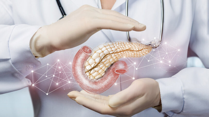 Tumore al pancreas, scoperto perché è aggressivo: aiuterà le terapie 1