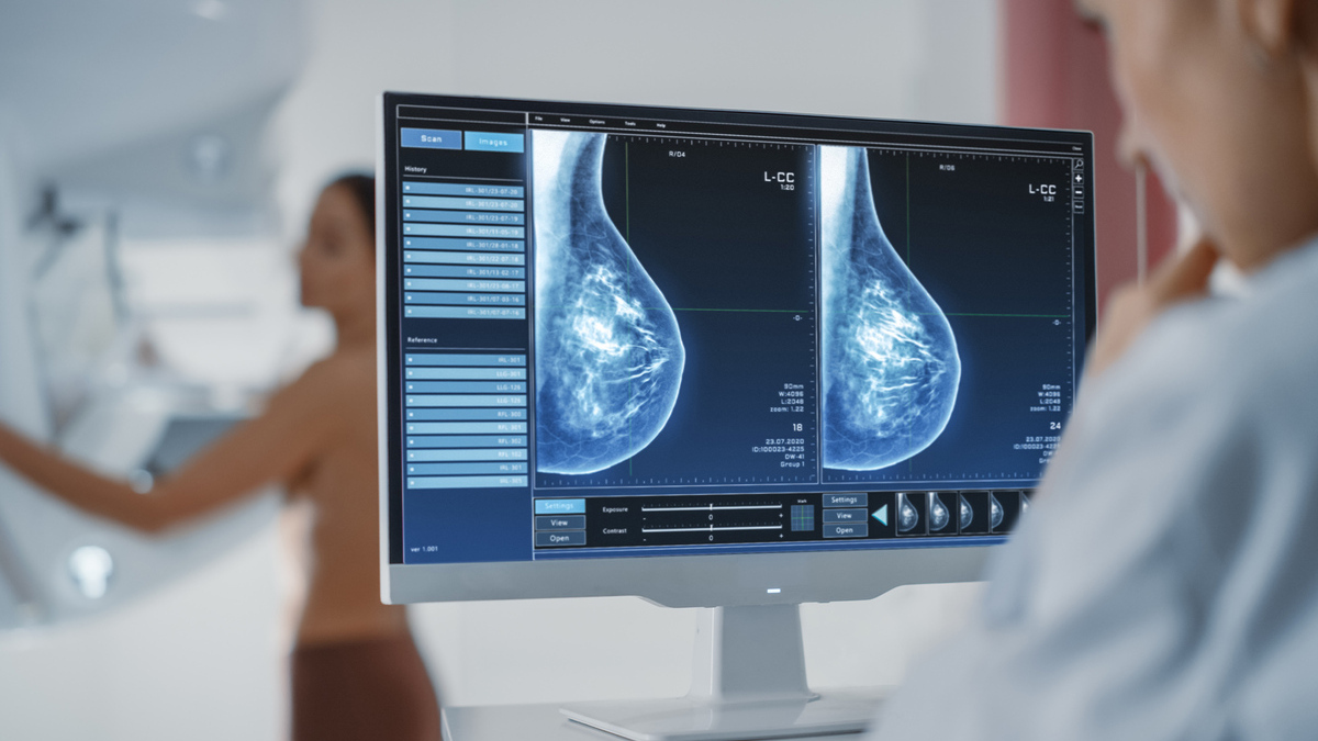 Tumore al seno, Italia avanti in UE con accesso a cure rimborsabili 19