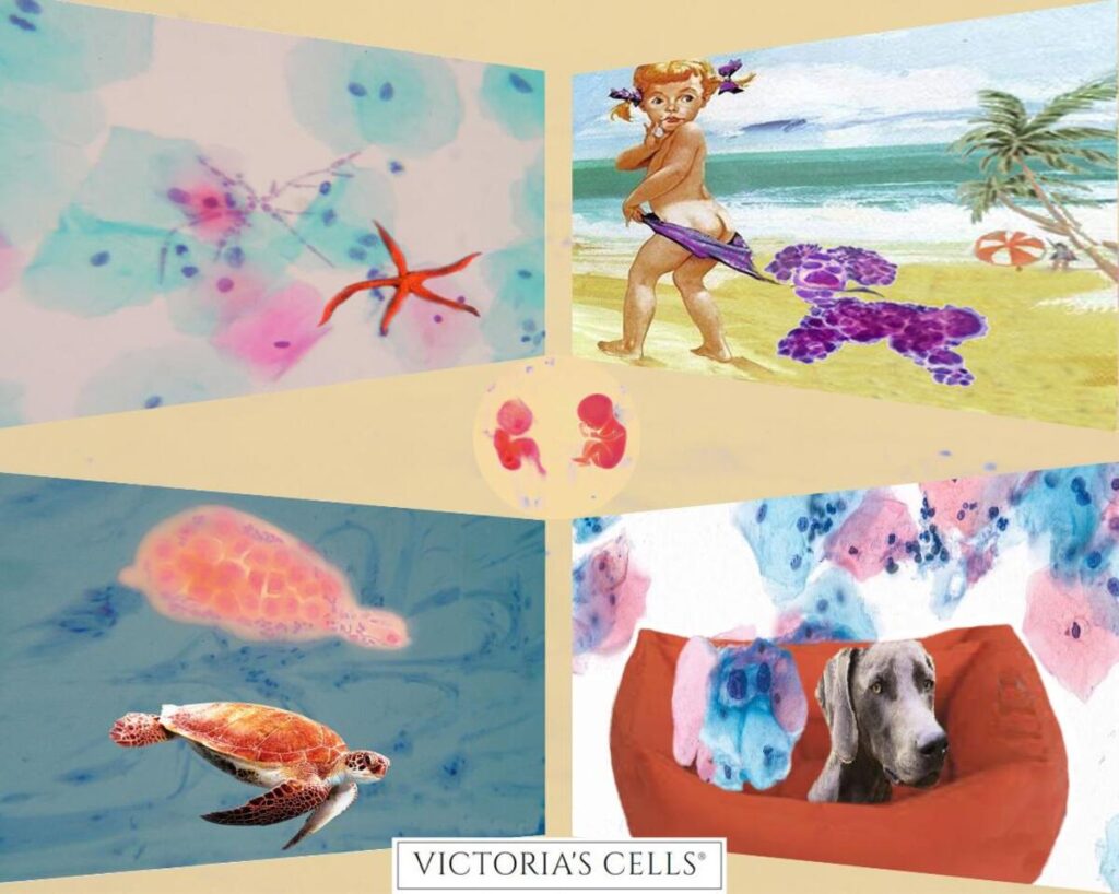 PAP-ART: l'HPV come non lo avete mai visto, victoria's cells