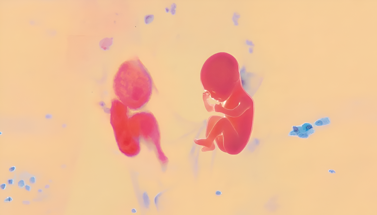 Arriva PAP-ART: il primo evento artistico sulla prevenzione del Papilloma Virus 1