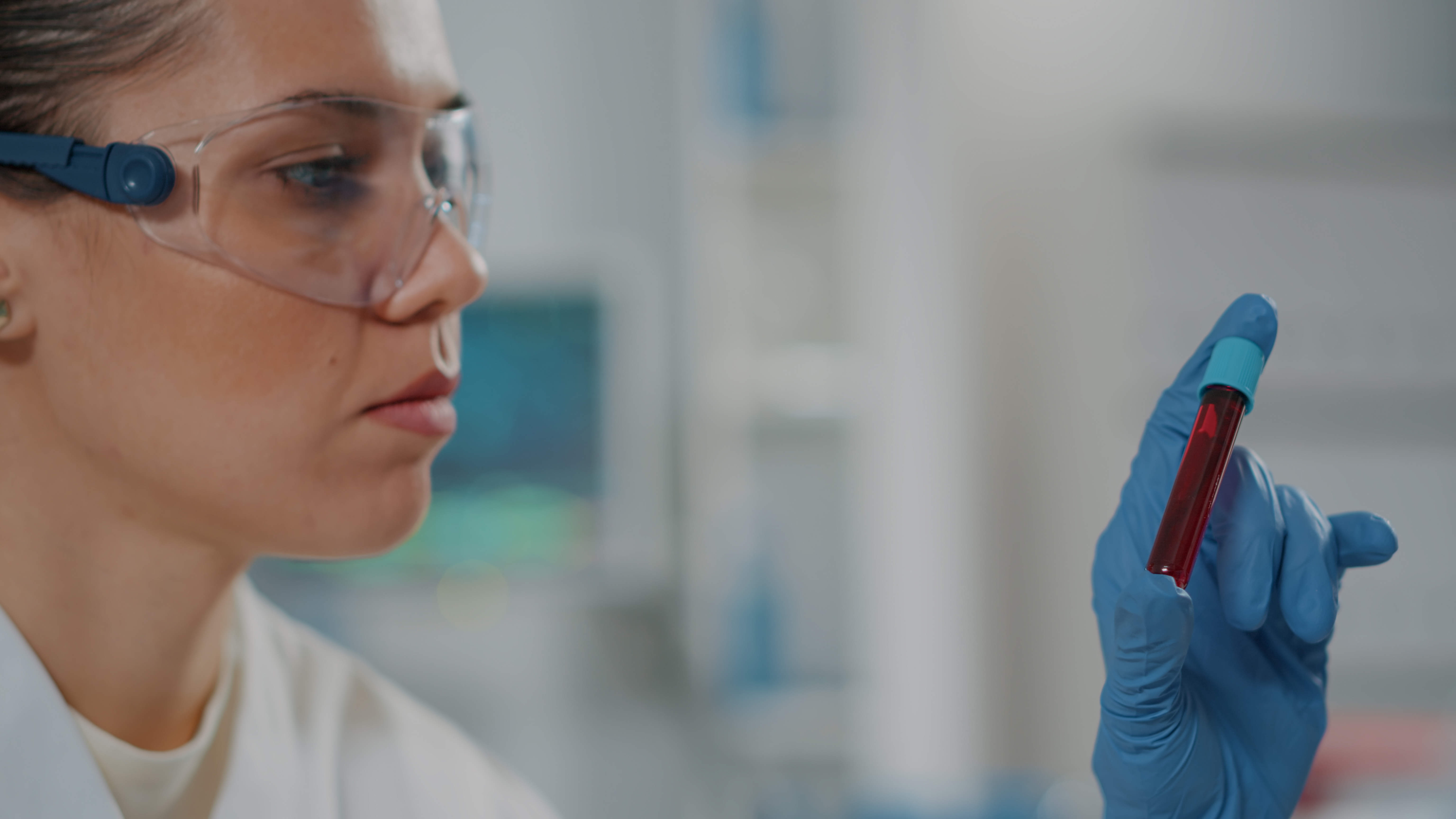 Individuate le cause della sclerosi multipla: c'entrano un virus e la genetica 2