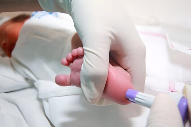 Puglia, screening neonatale salva neonato da una malattia rarissima: solo 4 casi al mondo 57