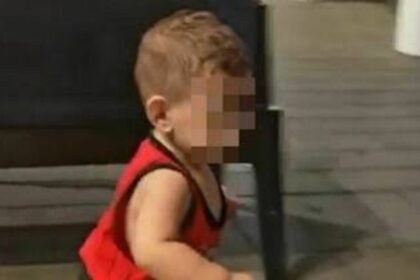 bimbo trapianto cuore bruciato