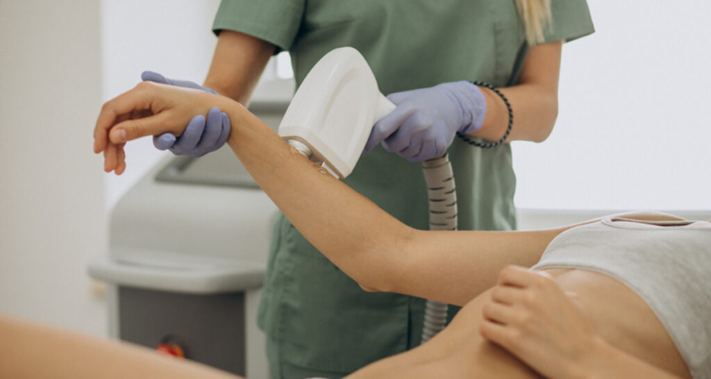 Epilazione laser definitiva, boom di richieste in Italia: cosa sapere su scelta e sicurezza 3