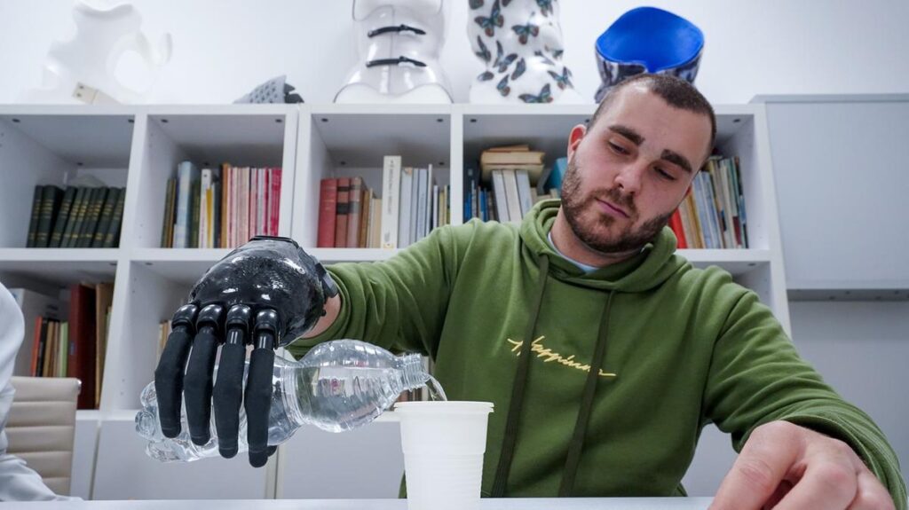 Il futuro delle protesi nell'era AI: "Non sostituiranno il corpo, ma aumenteranno l'autonomia della persona" 2 Protesi bionica
