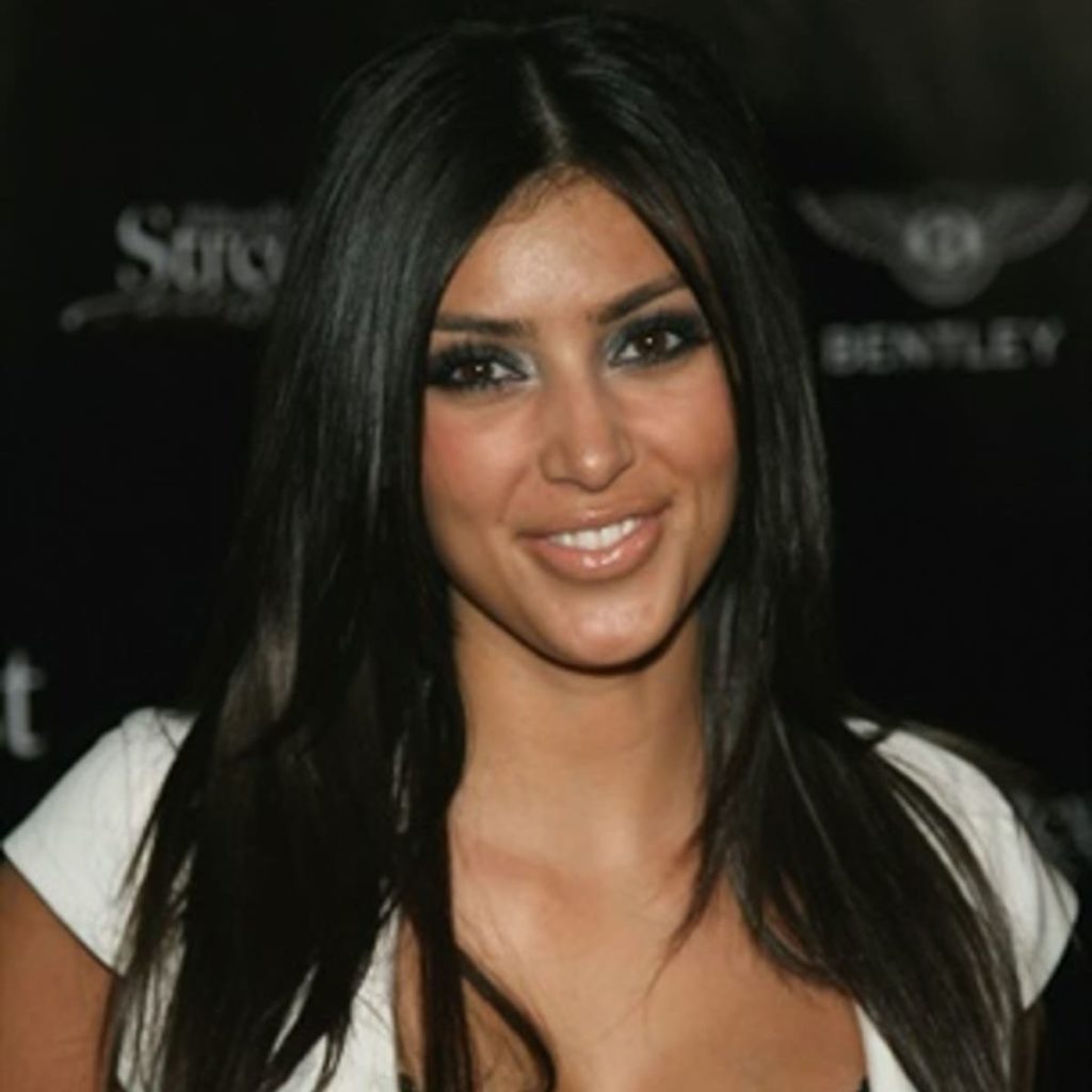 Kim Kardashian prima della chirurgia 