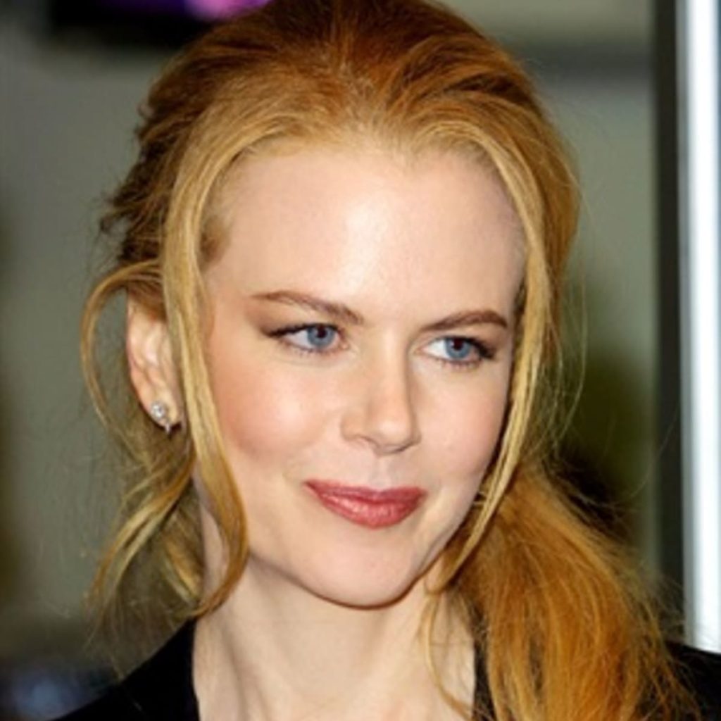 Nicole Kidman prima della chirurgia 