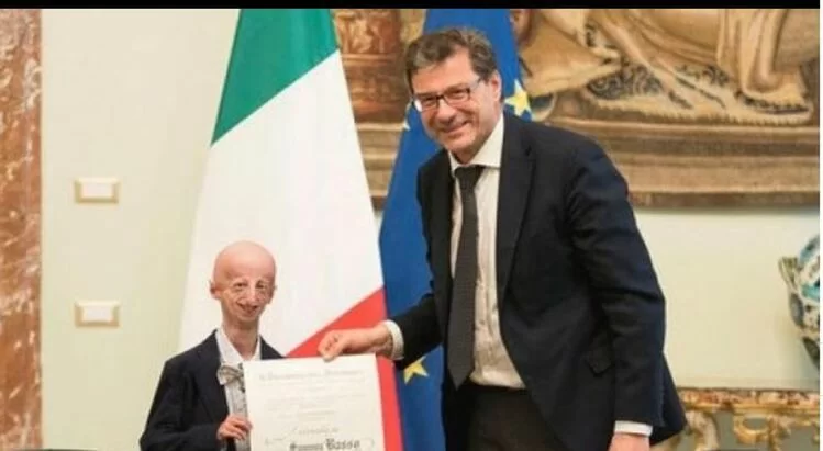 Sammy Basso si laurea per la seconda volta: il giovane affetto da progeria è dottore in Molecular Biology