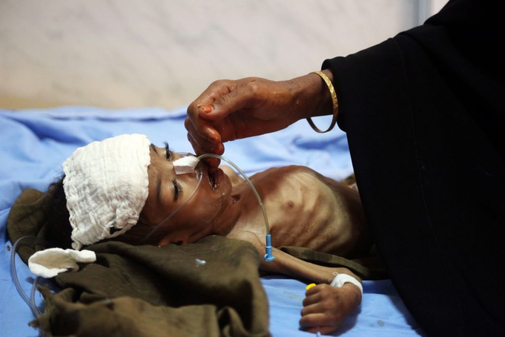 Secondo l'Onu la guerra in Yemen ha generato la peggior crisi umanitaria degli ultimi trent'anni