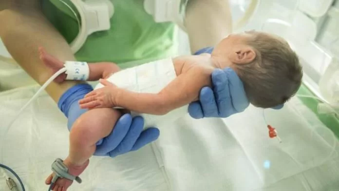 neonato operato durante il parto