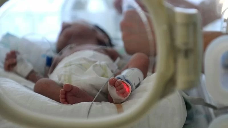 neonato operato durante il parto_
