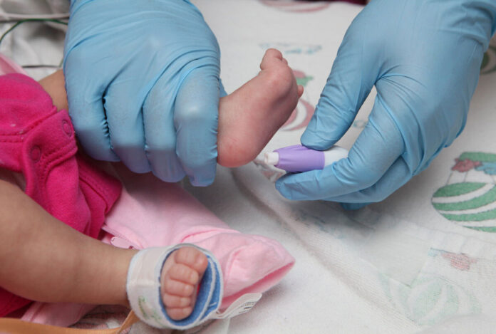 screening neonatale