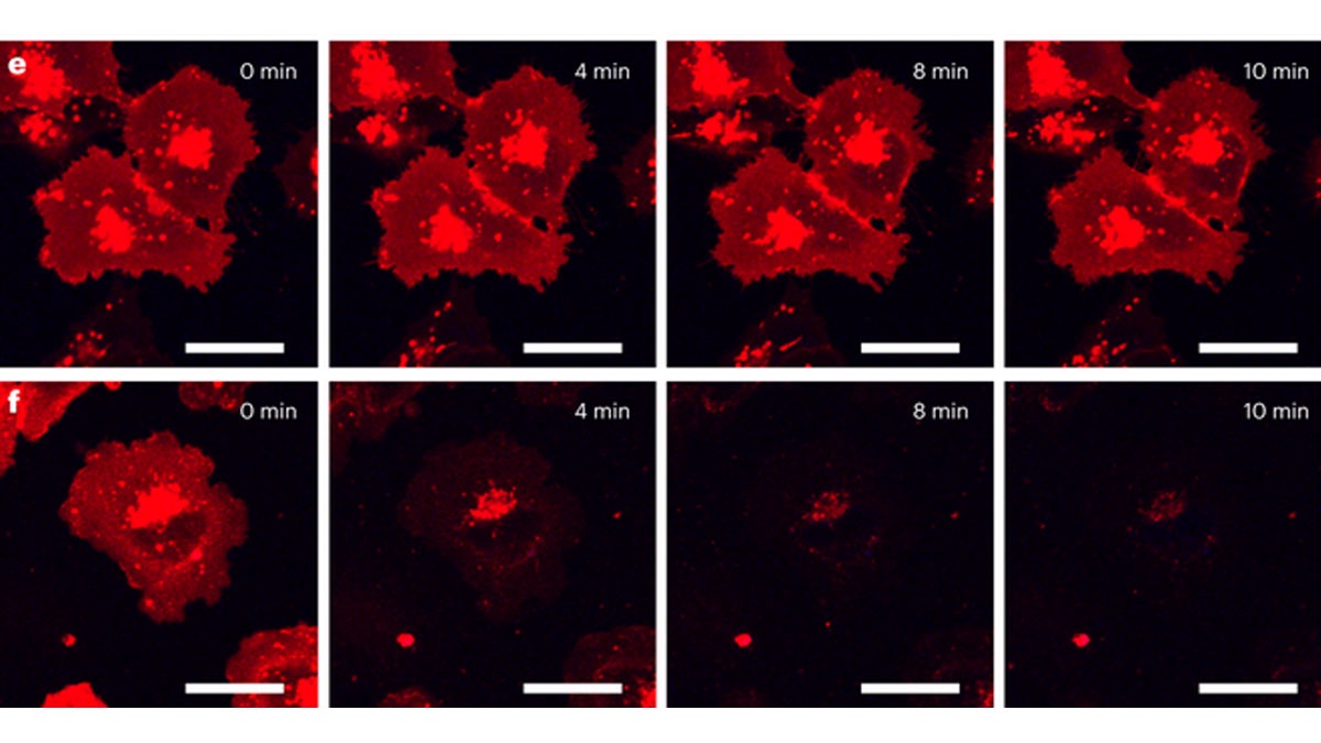 Cos'è, come funziona e come agisce il martello pneumatico antitumorale 5