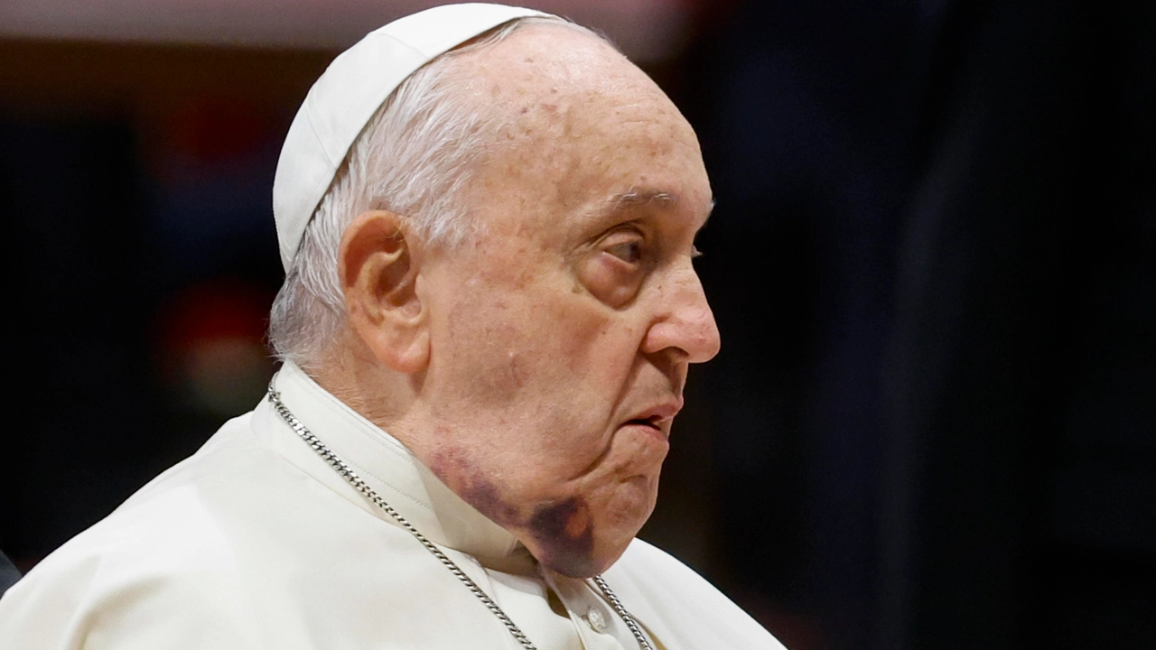 Come sta Papa Francesco, il quadro clinico attuale e cosa dicono i medici 3